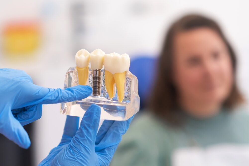 Dental model showing single tooth implant next to a traditional dental bridge